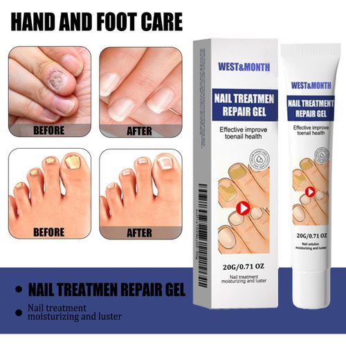 Gel réparateur pour ongles West & Month 20g, soin professionnel mains et pieds, soin doux pour entretien des ongles
