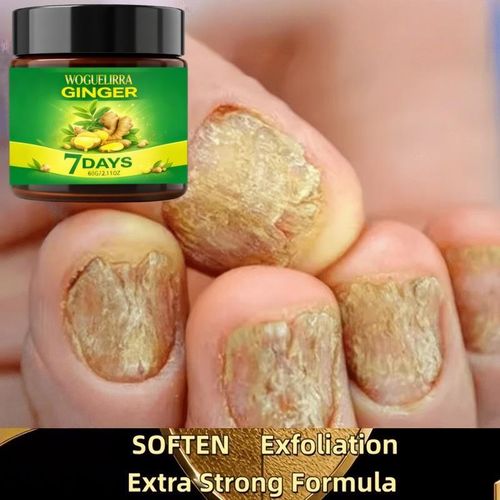 Crème pour les ongles à action rapide au venin d'abeille, formulée à base d'extraits de plantes et de venin d'abeille Pénétration puissante pour des ongles forts et sains Exfolie et répare les bords d'ongles fissurés et les talons secs