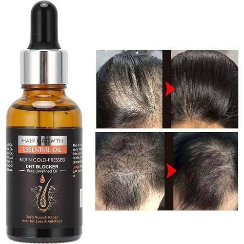 Kit 3 En 1 Pousse Cheveux Oil + Pousse Barbe Rapide + Meso Roller