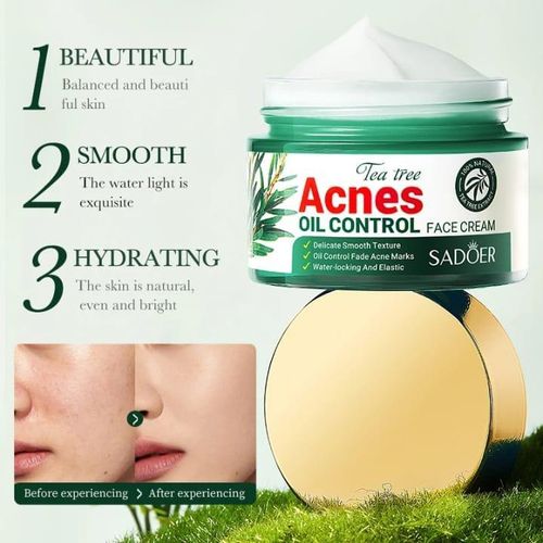 Crème visage anti-acné à l'huile d'arbre à thé, traitement de l'acné, formule hydratante