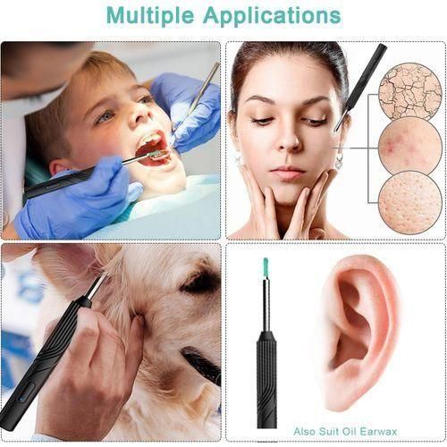 Éliminateur de cérumen intelligent à lumière émise, outil de retrait de cérumen - Noir