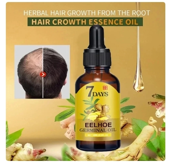 Huile Accélératrice de Croissance Capillaire en 7 Jours au Gingembre, Traitement Anti-Chute de Cheveux pour Hommes et Femmes, Sérum Traitant le Cuir Chevelu, Produits de Beauté