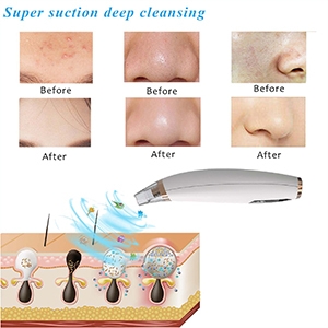 aspirateur points noirs