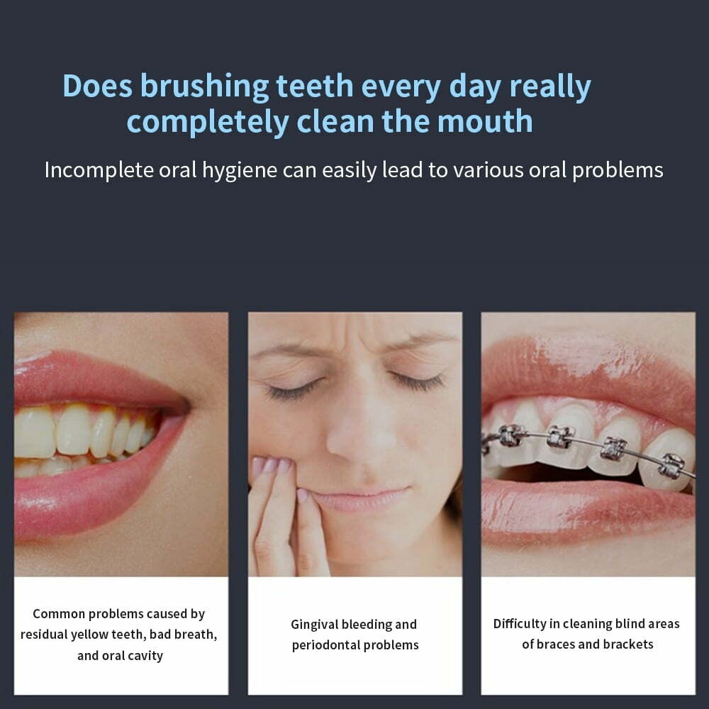 Water Flosser Dental Teeth Cleaner, Professional 280ML Tank USB Rechargeable Dental Oral Irrigator for Home and Travel, 3 Modes 4 Jet Tips, IPX7 Waterproof, Easy-to-Clean, White