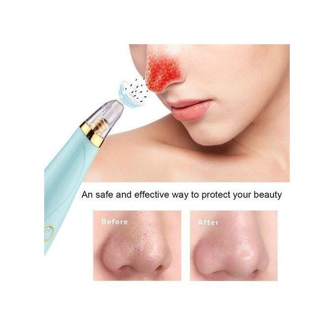 product_image_name-Generic-B lackhead remover pore vacuum acne remover-4