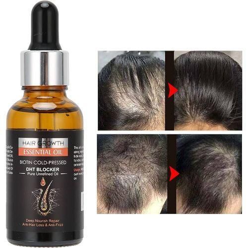 Pousse cheveux oil