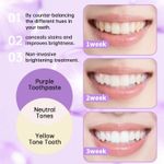 product_image_name-Mode-Blanchissement dentaire -3