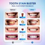 product_image_name-Generic-Soin Dentaire Éclaircissant Sans Fluor - Niacinamide - Spécial Dents Sensibles-3