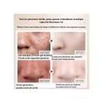 product_image_name-Generic-Nettoyant Éclaircissant à la Centella Asiatica - Anti Points Noirs, Formule Douce pour Peau Sensible 100g (Certifié COSMOS)--6