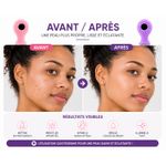 Generic Brosse de Nettoyage Visage Double Face en Silicone – Lot de 2 - image 6