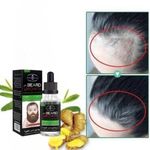 product_image_name-Aichun Beauty-Huile de Repousse Cheveux & Barbe – Traitement Anti-Calvitie – 30 ml-2