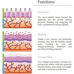 product_image_name-Generic-1pcs Outil De Soins De Beauté 540 Aiguilles Rouleau Titane Aiguille Visage Rouleau Lifting-3