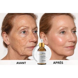 Sérum Anti-Âge au Rétinol & Niacinamide – Anti-Rides, Anti-Taches, Peau Lisse, Ferme et Éclatante | Soin Visage Hydratant Réparateur Anti-Âge