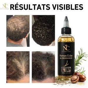 Sérum Capillaire Éclat & Croissance 100 ml – Soin Nourrissant Anti-Chute & Repousse
