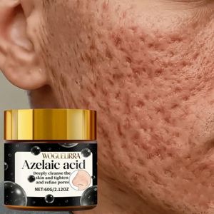 WOGUELIRRA Crème soin des pores à l'acide azélaïque 60 g, nettoyante et raffermissante pour le visage, convient à tous les types de peau. Contient du rétinol, de la glycérine et du miel. Procure une sensation de fraîcheur longue durée et une texture onctueuse.