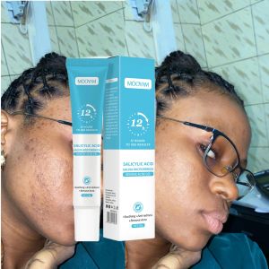 gel anti-acné MOOYAM à l'acide salicylique et Salvia miltiorrhiza.