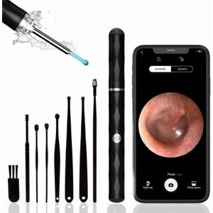 Nettoyant d'oreille sans fil avec caméra, Otoscope intelligent à cire d'oreille avec WiFi, Cure-oreilles visuel HD – Noir