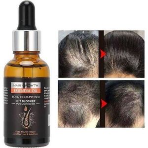 Gn Lot De Meso Roller 4en1 Plus Huile Oil Noir Pousse Cheveux