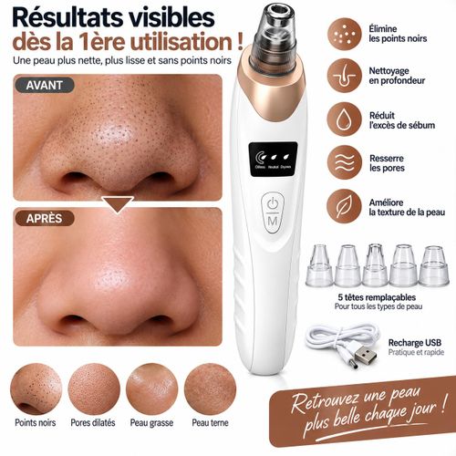 Generic Aspirateur Points Noirs - Nettoyage Visage Rechargeable - image 2