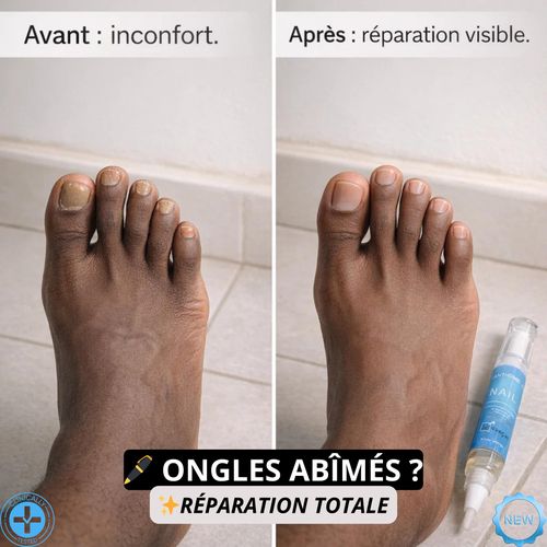 product_image_name-Lanthome-Nouveau - Stylo Réparateur Pro Ongles Abîmés-5