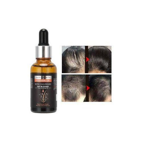Generic Kit 3en1 Huile Oil Plus Pousse Cheveux Rapide Plus Meso Roller 4en1