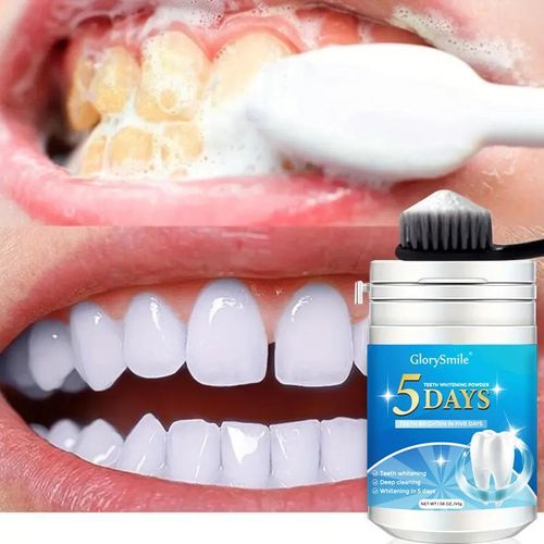 product_image_name-Generic-POUDRE DENTAIRE ÉCLAIRCISSANTE – DENTS BLANCHES EN 5 JOURS + HALEINE FRAÎCHE-1