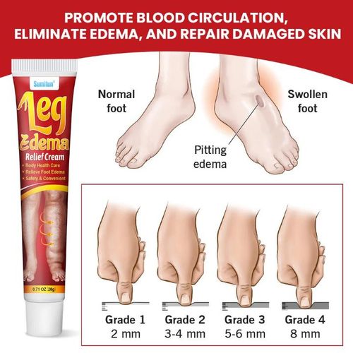 product_image_name-Generic-Crème naturelle à base de plantes pour éliminer l'enflure-1