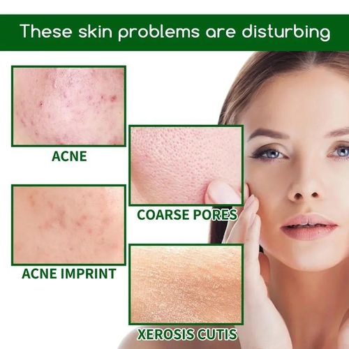 product_image_name-Gm-Essence anti-acné Niacinamide 10 % + Zinc 1 % Améliore la peau grasse-7