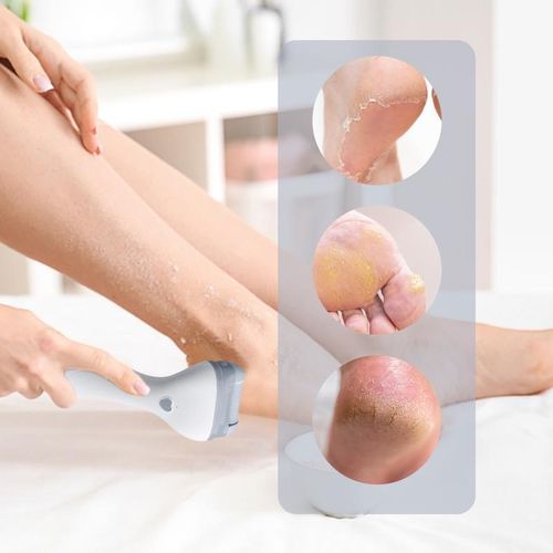 Generic Râpe à Pieds Électrique Torm Foot Grinder YB2024-1 - image 4