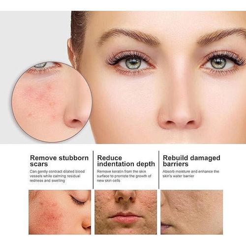 product_image_name-Generic-Essence faciale à la niacinamide, Eelhoe Niacinamide-3