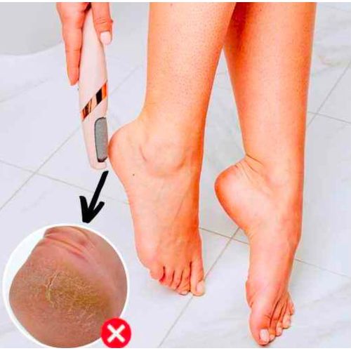 Generic Ponceuse Electrique Rechargeable pour les Pieds – Rose - image 2