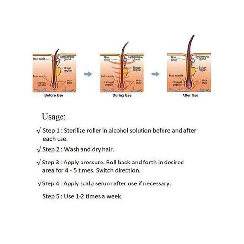 product_image_name-TiLECC-Derma Roller DermaRoller pour la croissance de la barbe et des cheveux - Taille 0,5 mm, outil de 540 micro-aiguilles en titane pour hommes et femmes-5