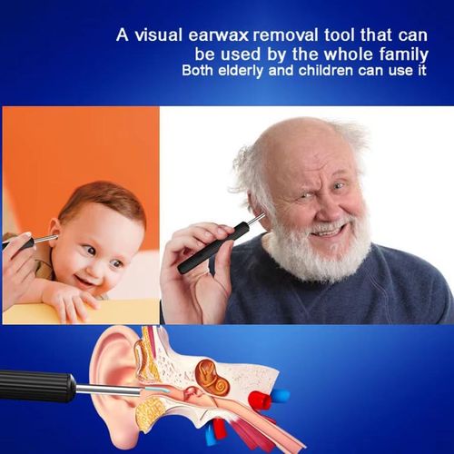 Generic Ensemble de cure-oreilles visuel, outil de retrait de cérumen HD - image 8
