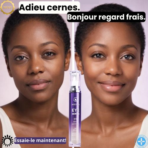 product_image_name-Generic-EYE MOOYAM 360° – Sérum Regard Défatigant à Bille Métallique-3