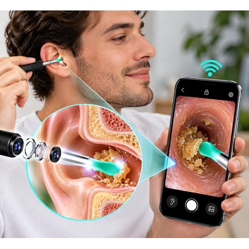 Generic Nettoyeur d’Oreilles Intelligent avec Caméra HD - image 4