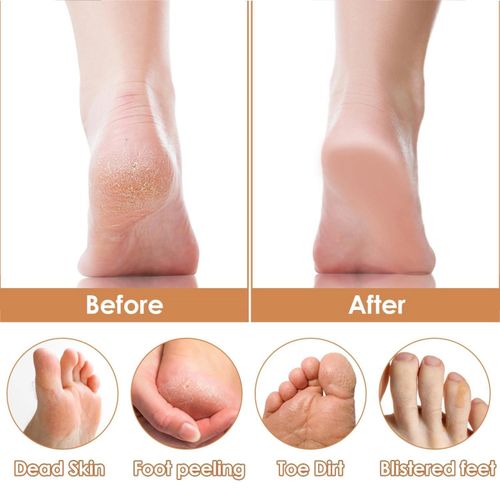 product_image_name-ShebSheb-Râpe à Pieds en Bois avec Pierre Ponçe – Lime de Pied Professionnelle pour Enlever les Callosités, Peau Morte et Talons Fendus-4