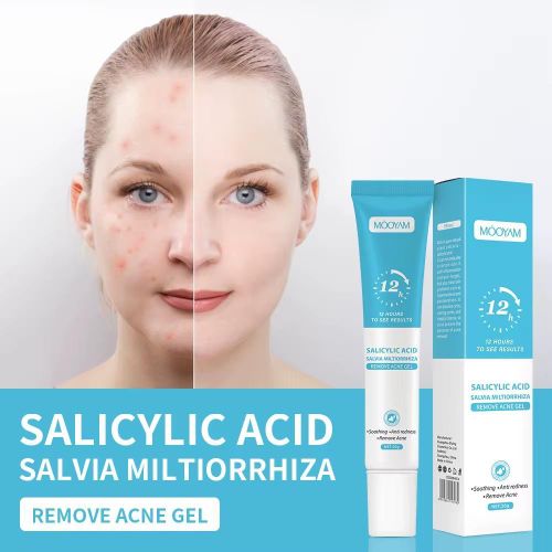 Mode Crème anti acné