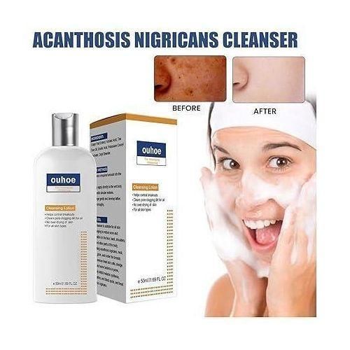 product_image_name-Generic-Ouhoe Lotion. Pour Visage Nettoyante Pour L'acné Et Les Taches Idéal Pour Peaux Foncées Et Sèches. Hydratant Nourrie Et Revitalisée. Tout Type De Visage Et 100% Naturel 50ML-1