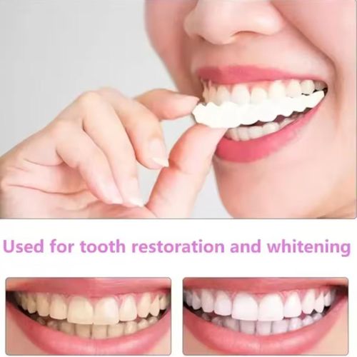 Generic Kit de plateau de blanchiment des dents réutilisable avec étui de stockage - image 5