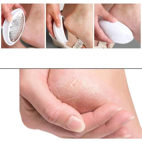 Generic Râpe pédicure double face pour pieds avec limes interchangeables