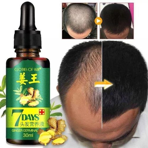 Generic Beard Growth Huile pour pousse des cheveux - image 4