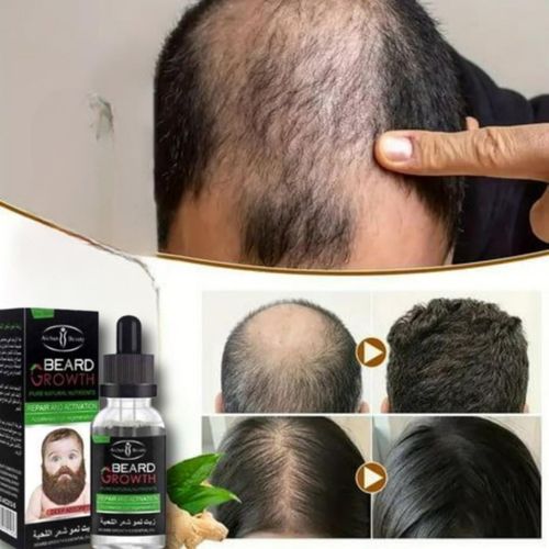 product_image_name-Aichun Beauty-Huile de Repousse Cheveux & Barbe – Traitement Anti-Calvitie – 30 ml-1