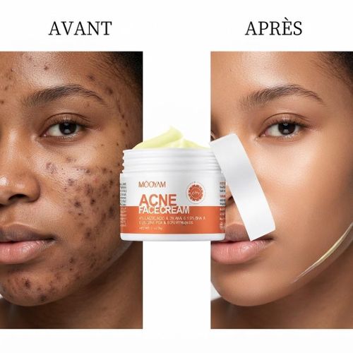 MOOYAM Crème Visage Anti-Acné & Taches
