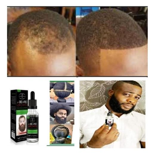 Beauty Produit Américain Faire Pousser Les Cheveux Et La Barbe En 15 Jours