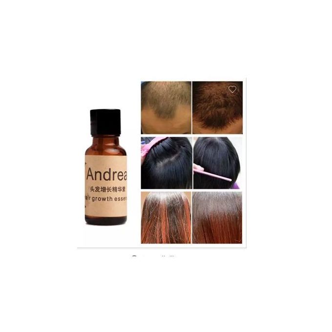 product_image_name-Andrea-Huile Essentielle De Pousse Cheveux Rapide - Calvitie-1