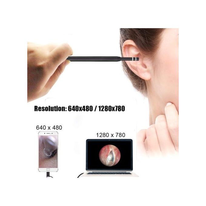 VINGVO Kit d'endoscope de nettoyage des oreilles Kit d'élimination