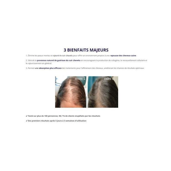 product_image_name-Generic-Dermaroller Appareil Facial Professionnel-4