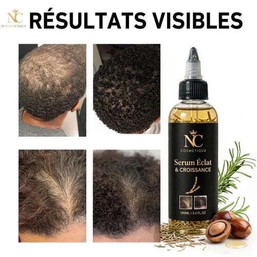 Sérum Capillaire Éclat & Croissance 100 ml – Soin Nourrissant Anti-Chute & Repousse